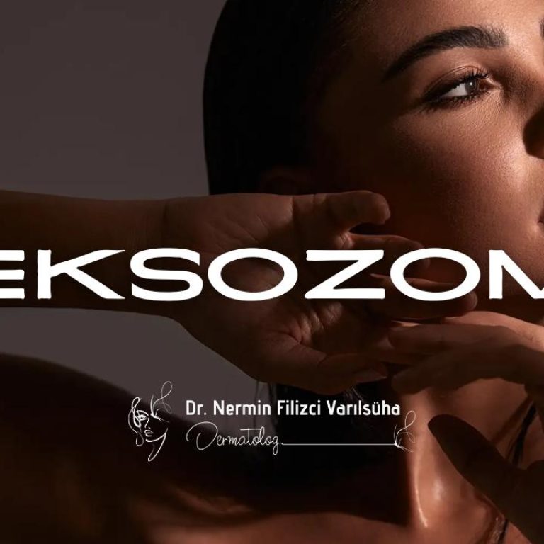 eksozom